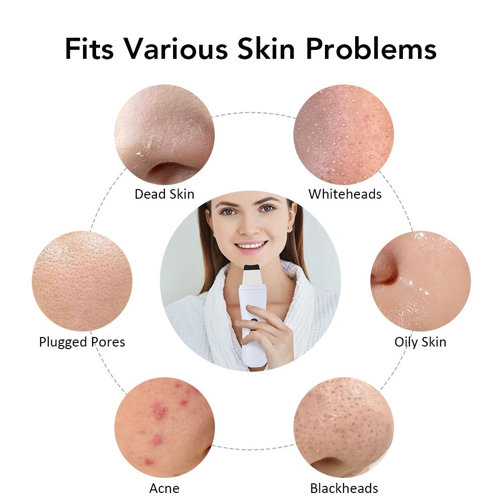 GlowSonic 4-Mode Skin Scrubber